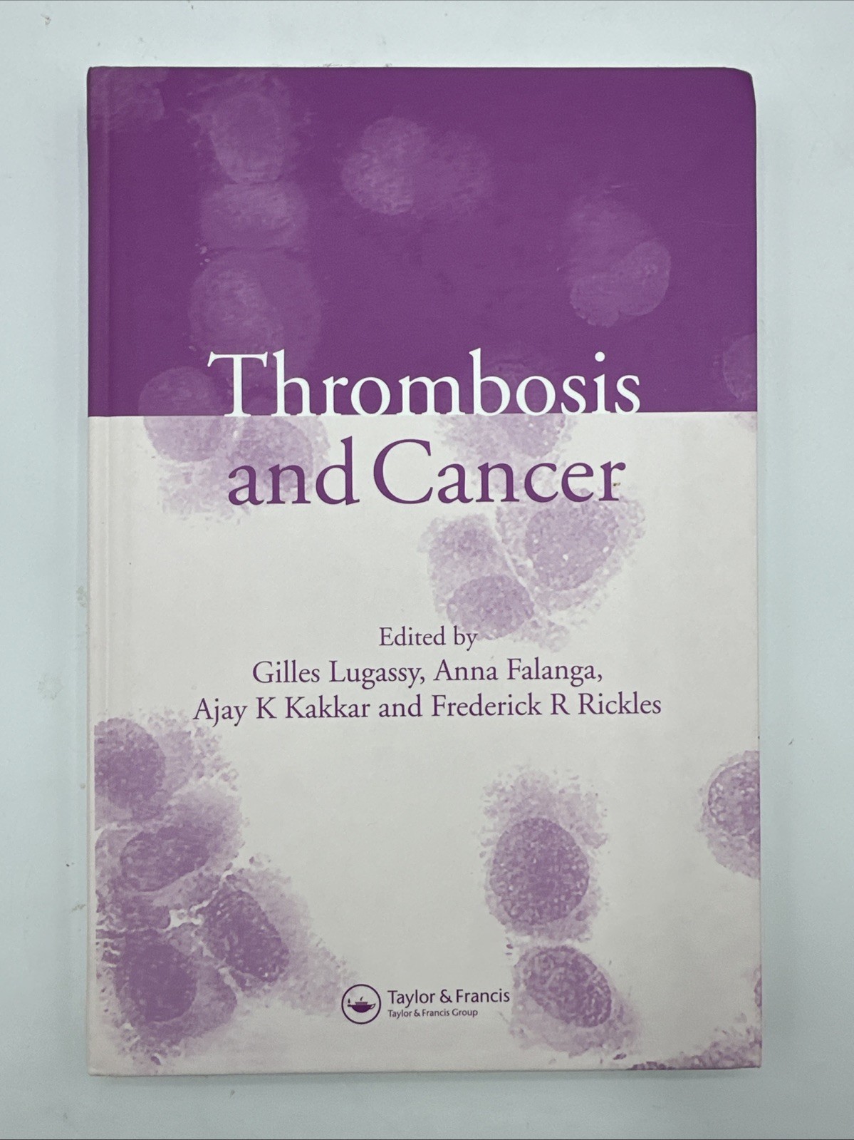 Thrombosis and Cancer by Anna Falanga (2004, Hardcover)