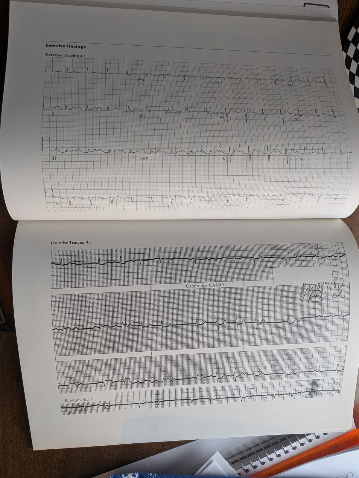 Basic Electrocardiography by Brent G. Petty (2020, Trade Paperback).