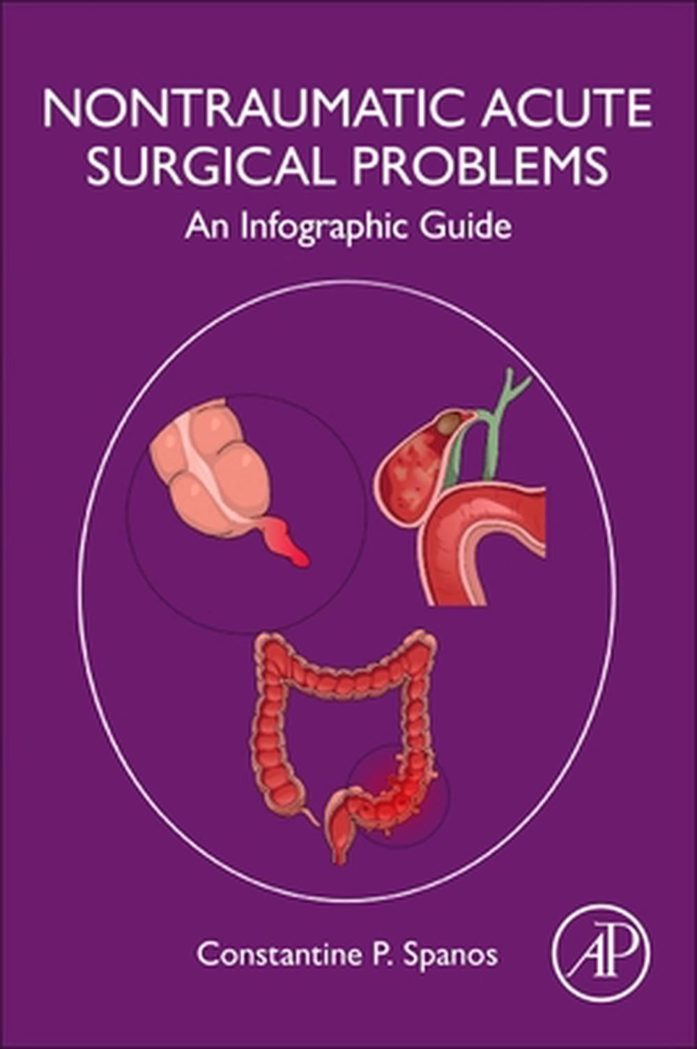 Non-Traumatic Acute Surgical Problems: An Infographic Guide by Constantine P. Sp