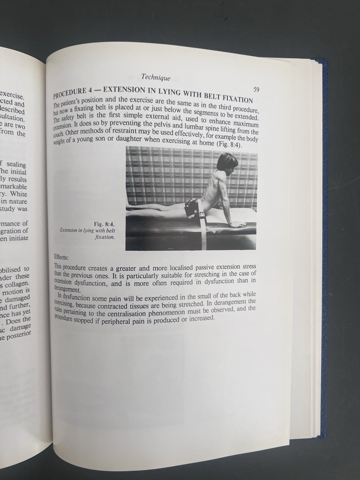 The Lumbar Spine Mechanical Diagnosis Mckenzie 1991 OMM OMT DPT Physical Therapy