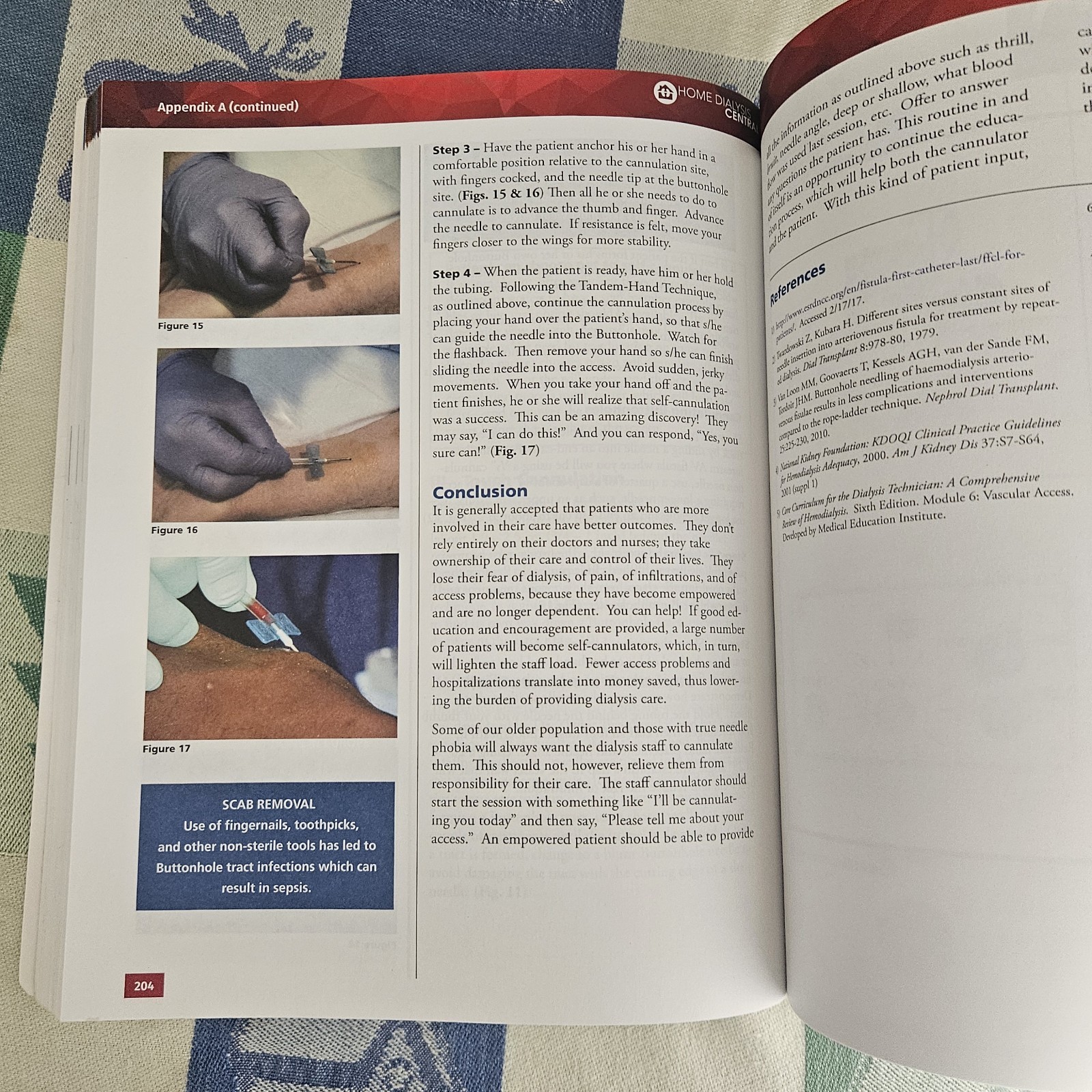 Core Curriculum for the Dialysis Technician – 6th Edition