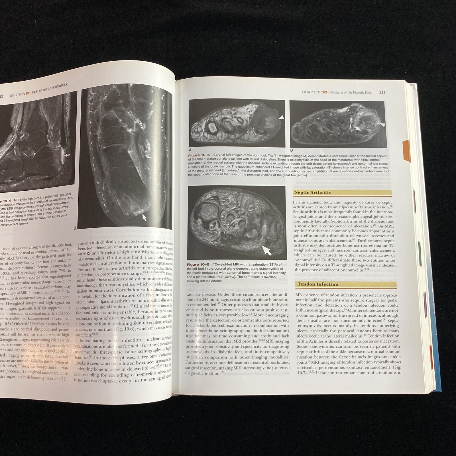 Levin and O’Neal’s The Diabetic Foot with CD-ROM by Bowker MD 7th Ed 2008 Signed