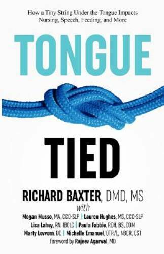 Tongue-Tied: How a Tiny String Under the Tongue Impacts Nursing, Speech, – GOOD
