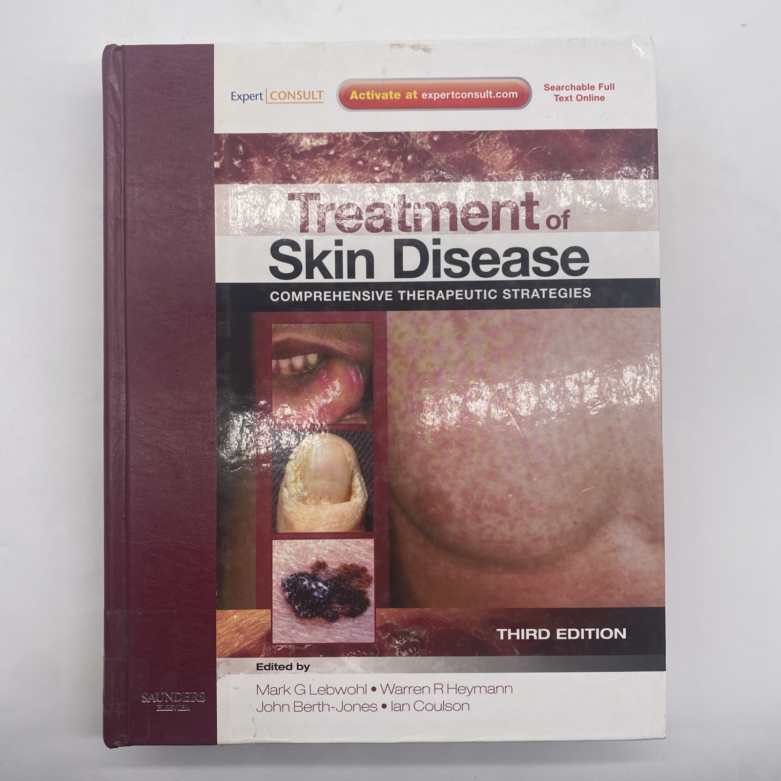 Treatment Of Skin Disease Comprehensive Therapeutic Strategies Third Edition