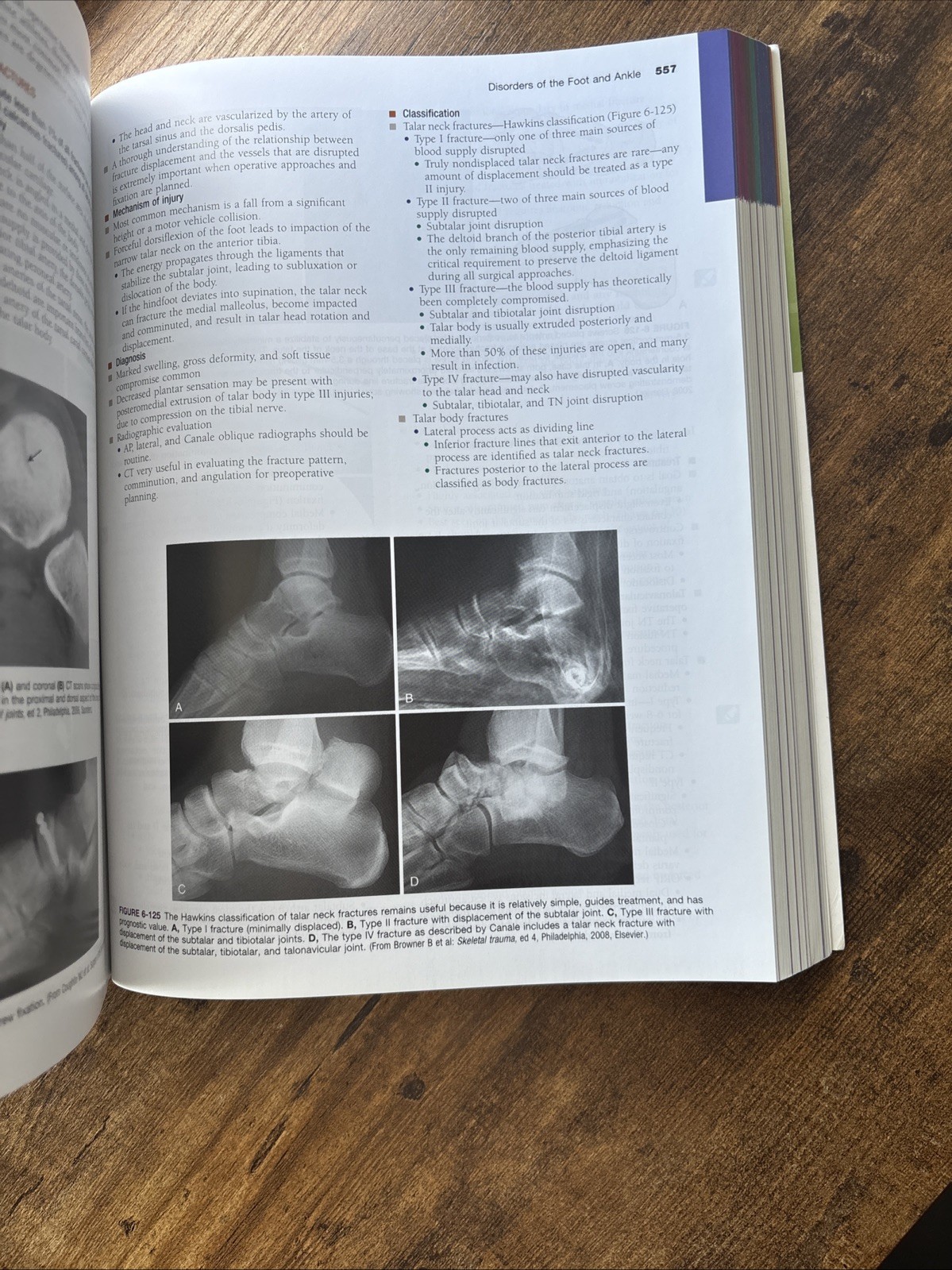 Miller’s Review of Orthopaedics by Stephen R. Thompson and Mark D. Miller 2015