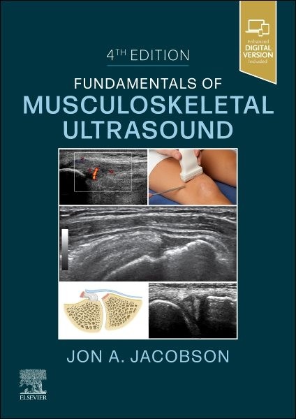 Fundamentals of Musculoskeletal Ultrasound, Paperback by Jacobson, Jon A., Br…
