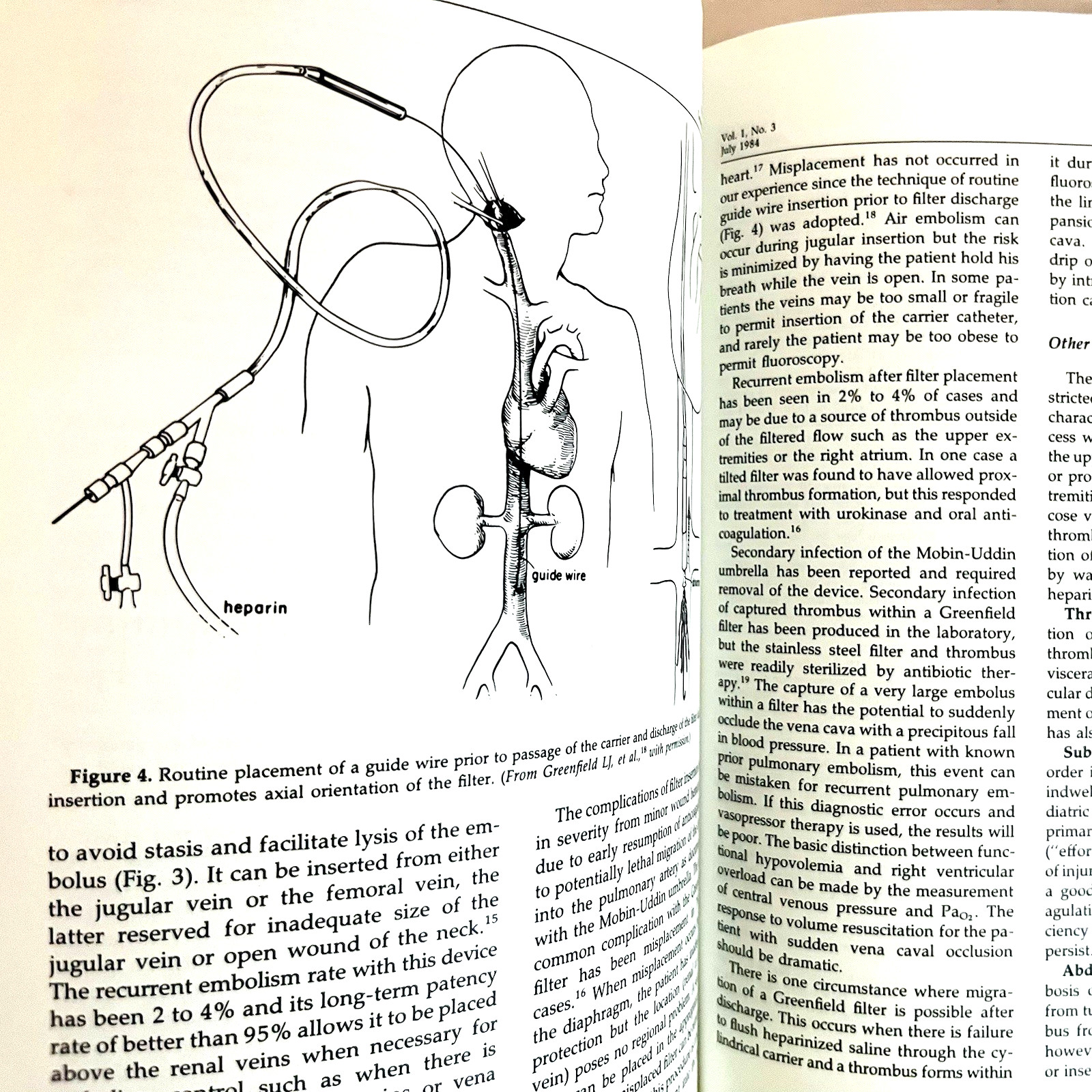 Difficult Surgical Infections Problems in General Surgery Lot of 4 Books 1984