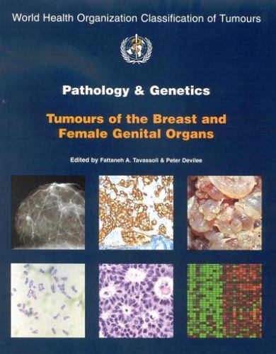 Pathology and Genetics of Tumours of the Breast and Female Genital Organs…