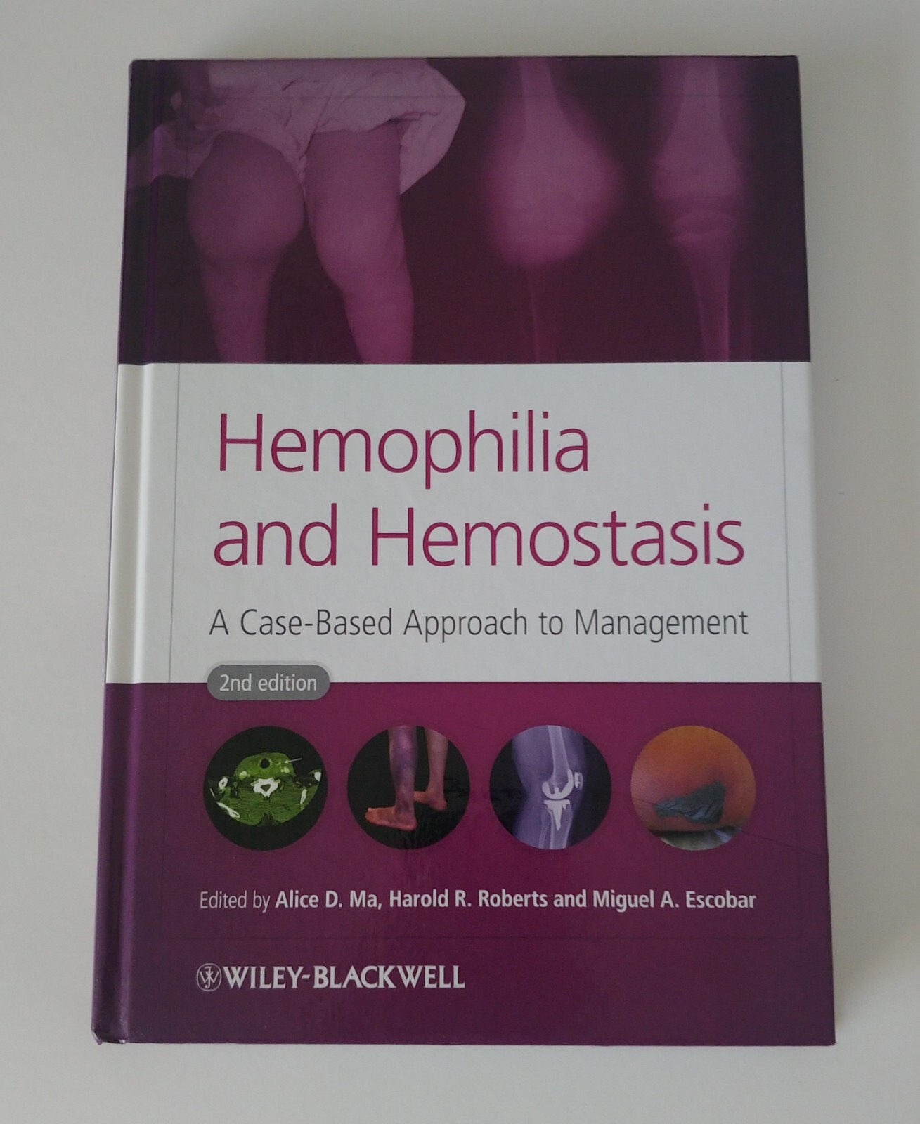 Hemophilia and Hemostasis : A Case-Based Approach to Management by Harold R….