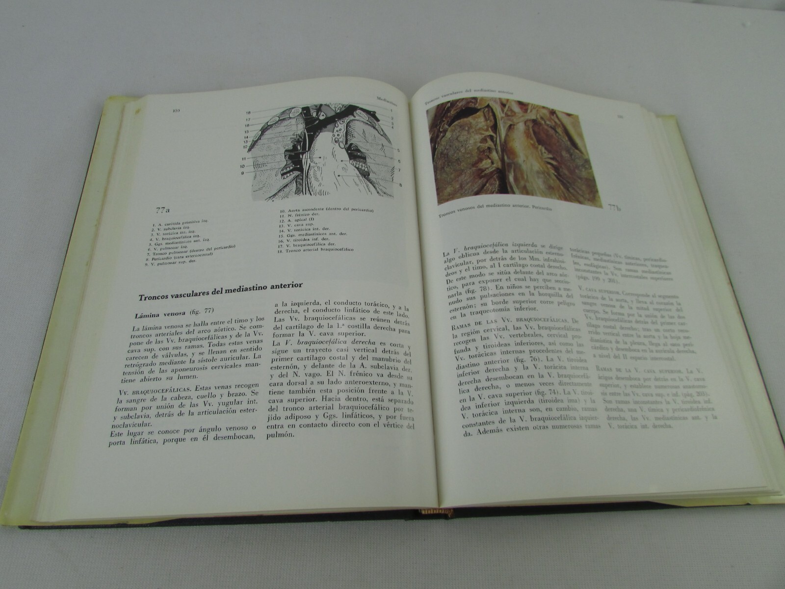 Atlas Fotográfico En Color De Anatomía Humana Con Aplicaciones Clínicas Torax