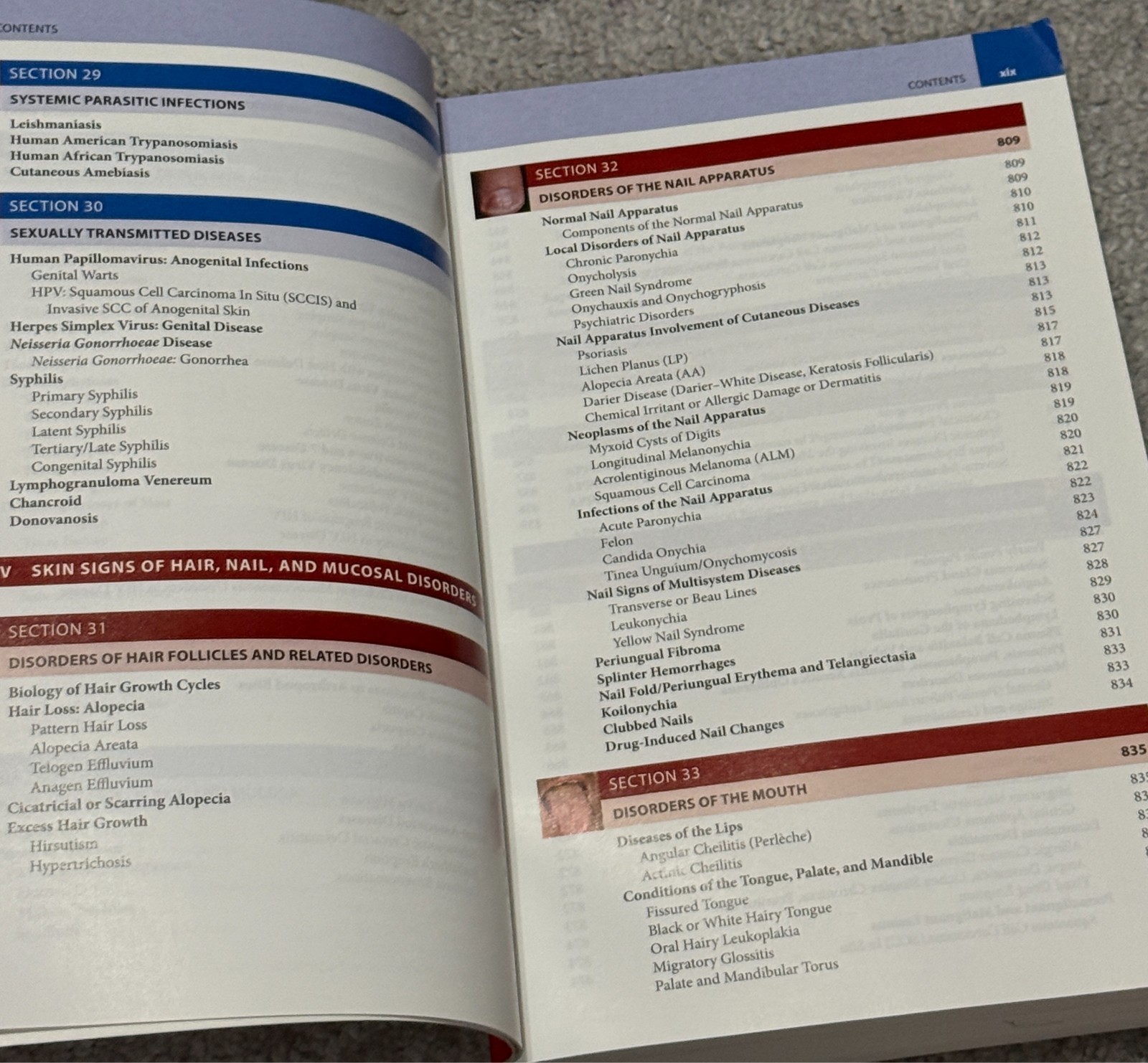 Fitzpatrick’s Color Atlas Clinical Dermatology 8th Edition Paperback Klaus Wolff