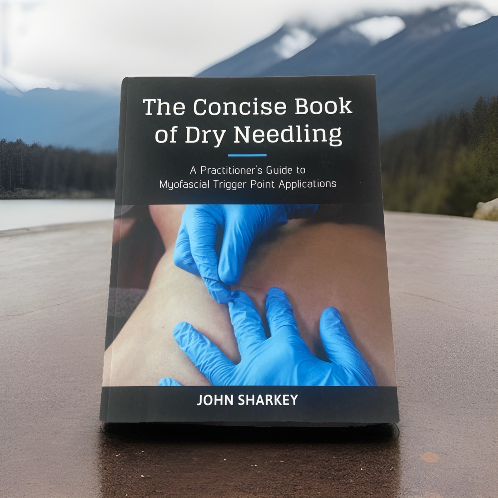 John Sharkey The Concise Book of Dry Needling (Paperback) (UK IMPORT)