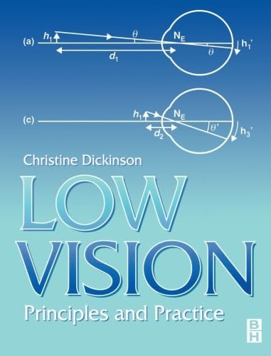 Low Vision: Principles and Pract… by Dickinson, Christine Paperback / softback