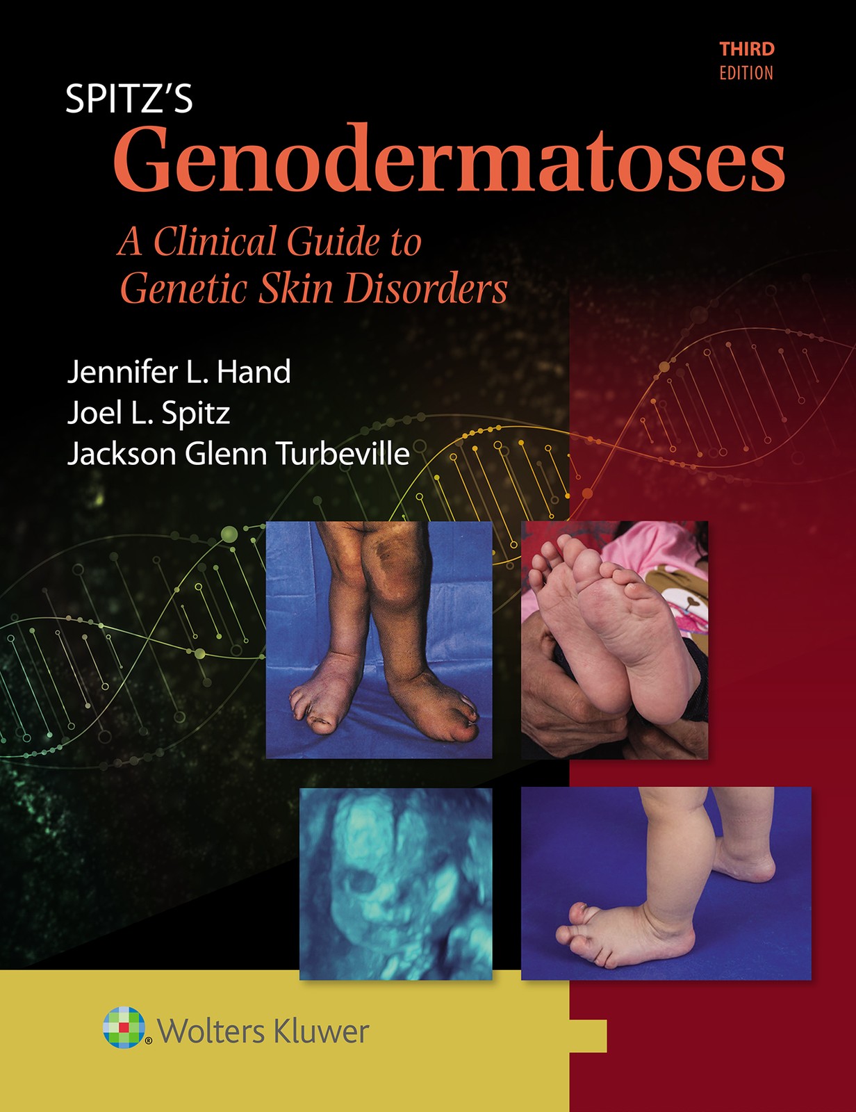 Joel L. Spitz Jennifer Lynn Hand Jackson Spitz’s Genoder (Hardback) (UK IMPORT)