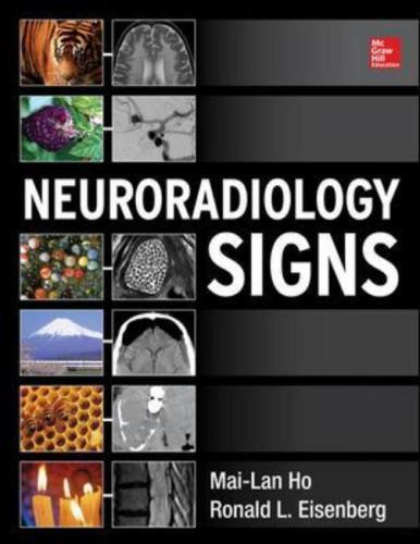 Neuroradiology Signs by Eisenberg, Ronald L., Ho, Mai-Lan (Hardcover)
