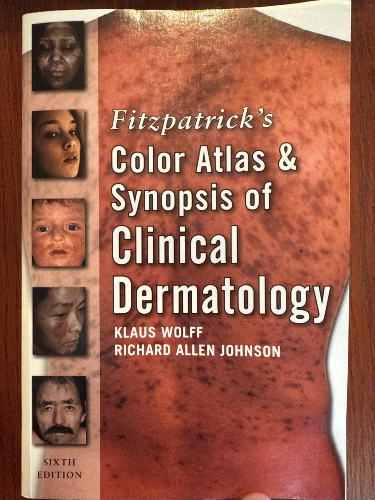 Color Atlas and Synopsis of Clinical Dermatology by Richard A. Johnson, Richard