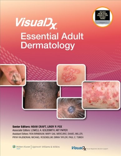 VISUALDX: ESSENTIAL ADULT DERMATOLOGY (VISUALDX: THE By Goldsmith Md Lowell A.