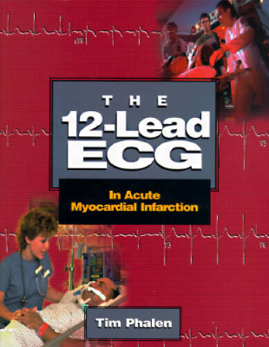 The 12-Lead ECG: In Acute Myocardial Infarction – Paperback – GOOD
