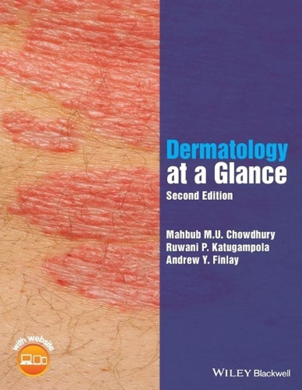 Dermatology at a Glance by Mahbub M.U. Chowdhury (English) Paperback Book