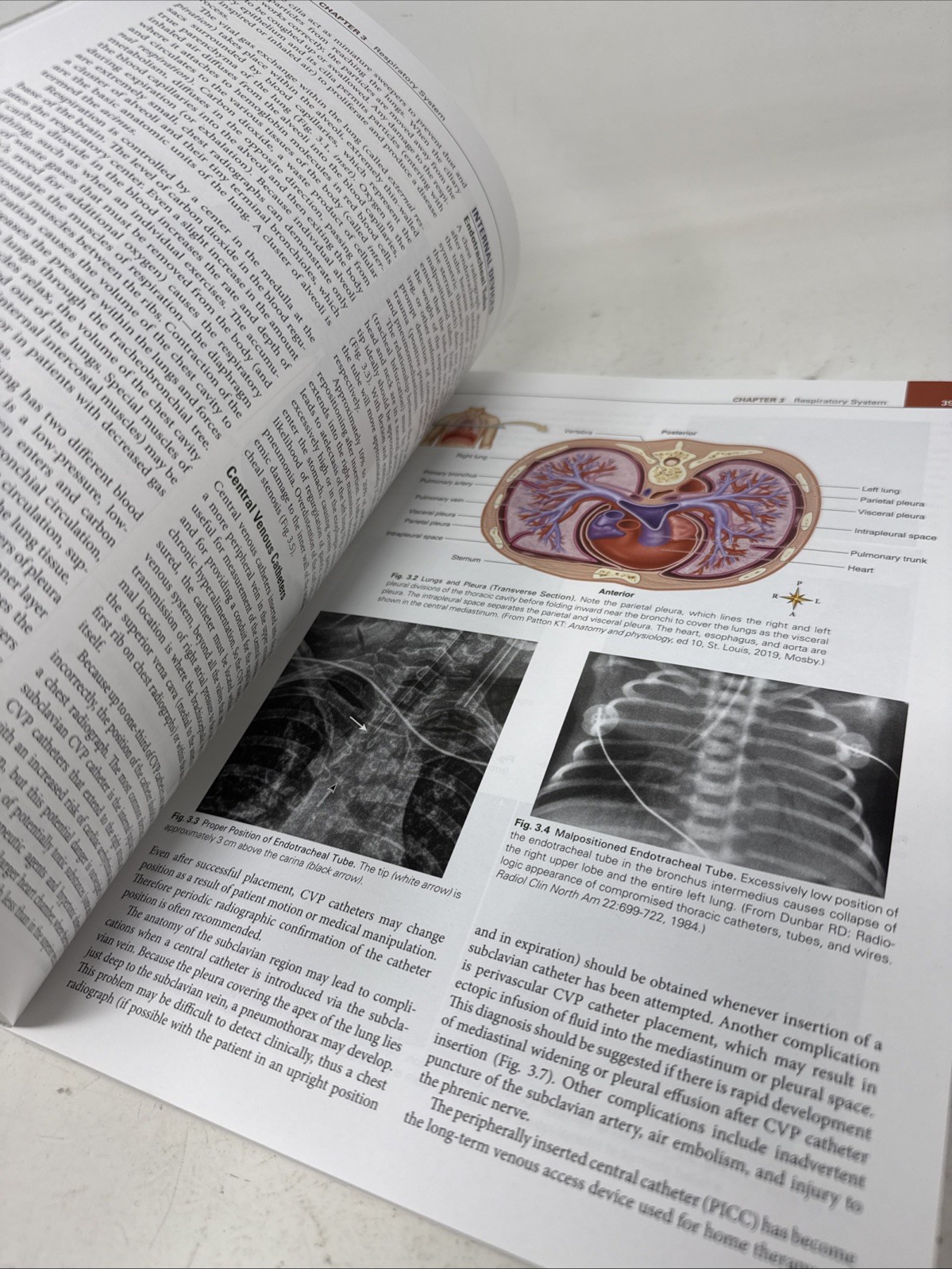 Comprehensive Radiographic Pathology 8th Edition W/ Code