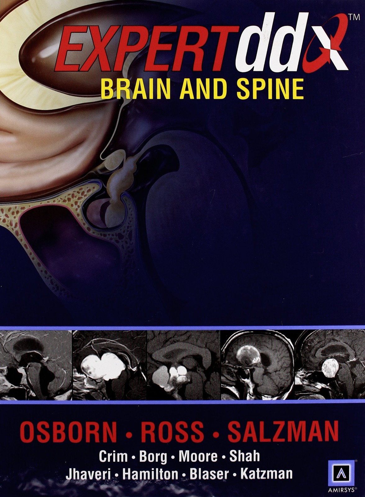 Expertddx: Brain and Spine – hardcover Anne G. Osborn|Julia Crim|Karen L. Sa…