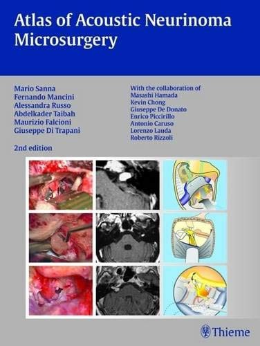 ATLAS OF ACOUSTIC NEURINOMA MICROSURGERY: . ZUS.-ARB.: By Mario Sanna & Fernando