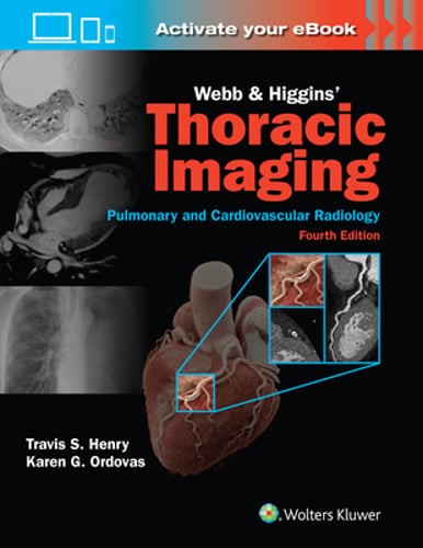 Webb & Higgins Thoracic Imaging: Print + eBook with Multimedia by Henry: Used