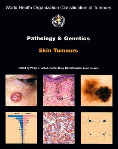 Pathology and Genetics of Skin Tumours (IARC WHO Classification of T – GOOD