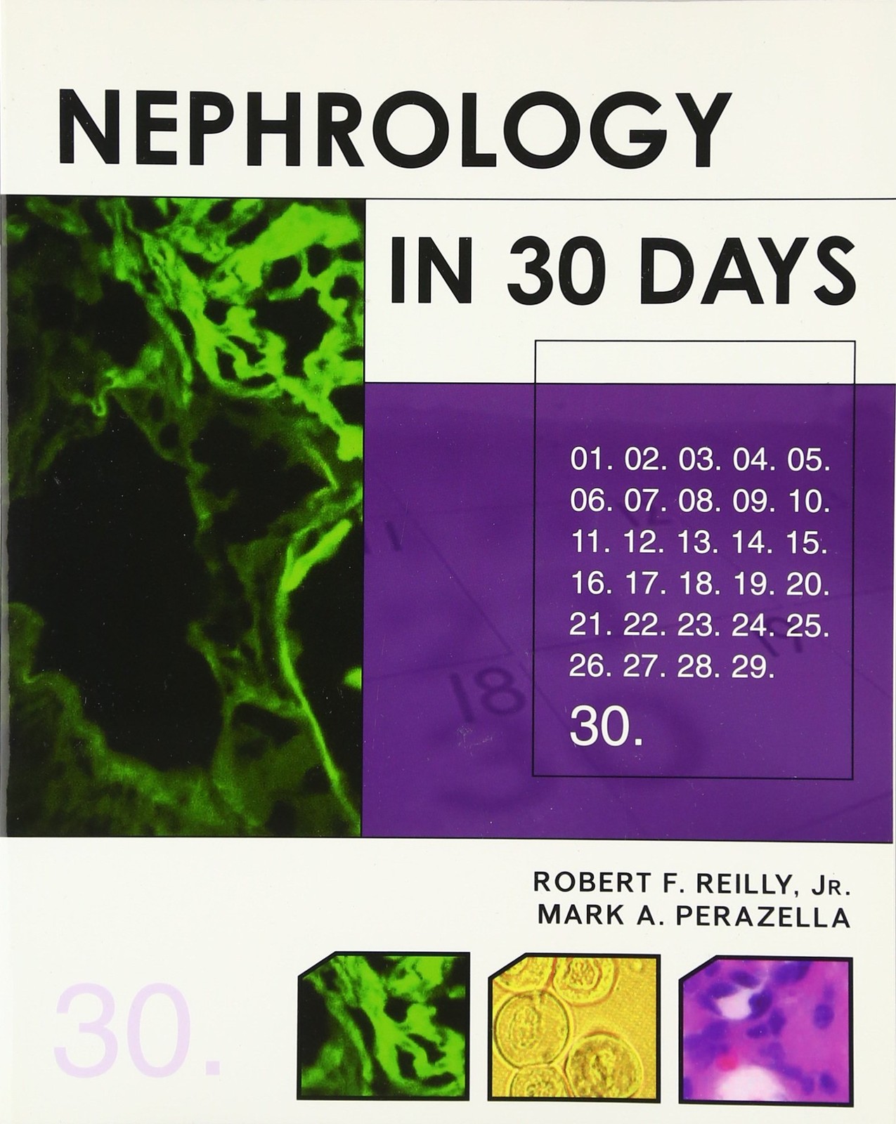 Nephrology in 30 Days (30 Days Series) by Mark Perazella