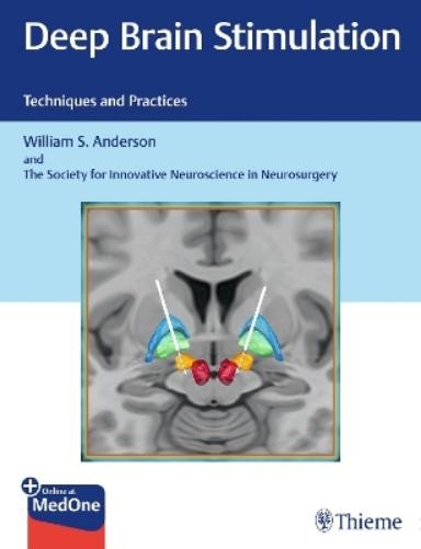 William S. Anderson The Societ Deep Brain Stim (Mixed Media Product) (UK IMPORT)