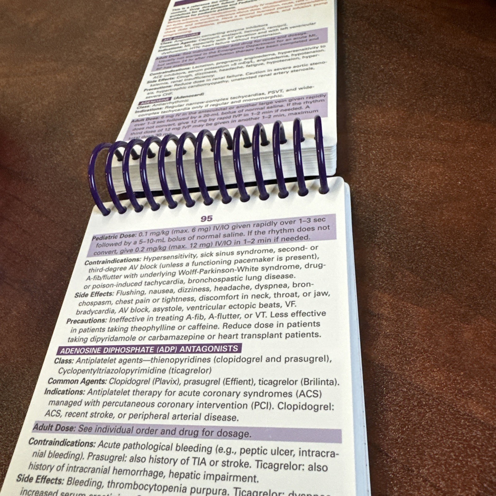 ECG Notes: Interpretation and Management Spiral-bound By Jones, Shirley Nursing