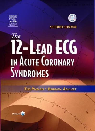 The 12-Lead ECG in Acute Coronary Syndromes Text and Pocket Reference Package, T