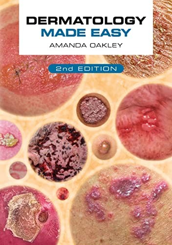 DERMATOLOGY MADE EASY SECOND EDITION by Amanda Oakley Adjunct Associate