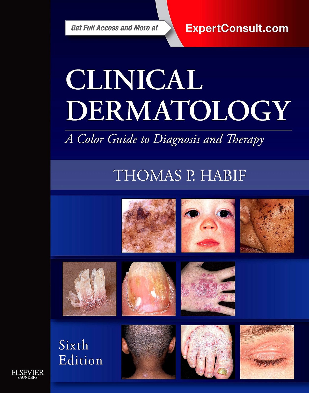 Clinical Dermatology: A Color Guide to Diagnosis and Therapy by Habif MD