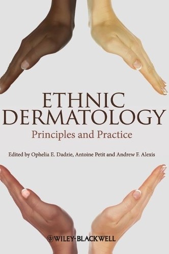 Ophelia E. Dadzie Antoine Petit Andrew F. Ethnic Dermatol (Hardback) (UK IMPORT)