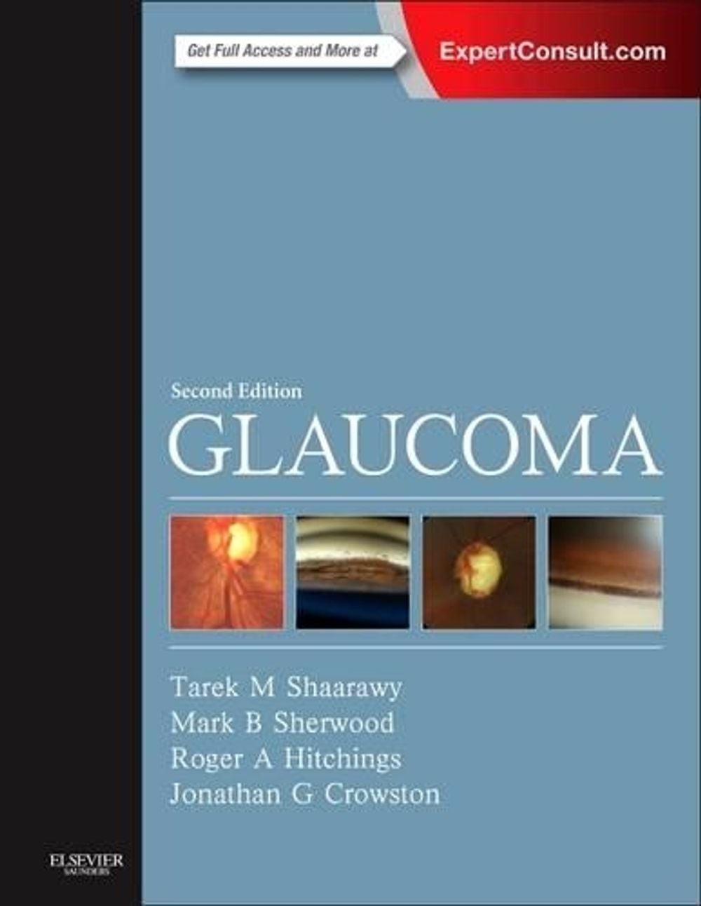 Glaucoma: 2-Volume Set by Mark B. Sherwood (English) Paperback Book