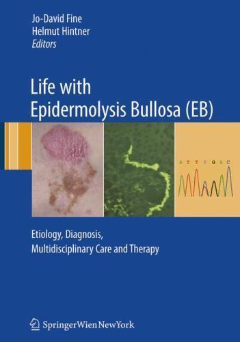 Life With Epidermolysis Bullosa Eb : Etiology, Diagnosis, Multidisciplinary C…