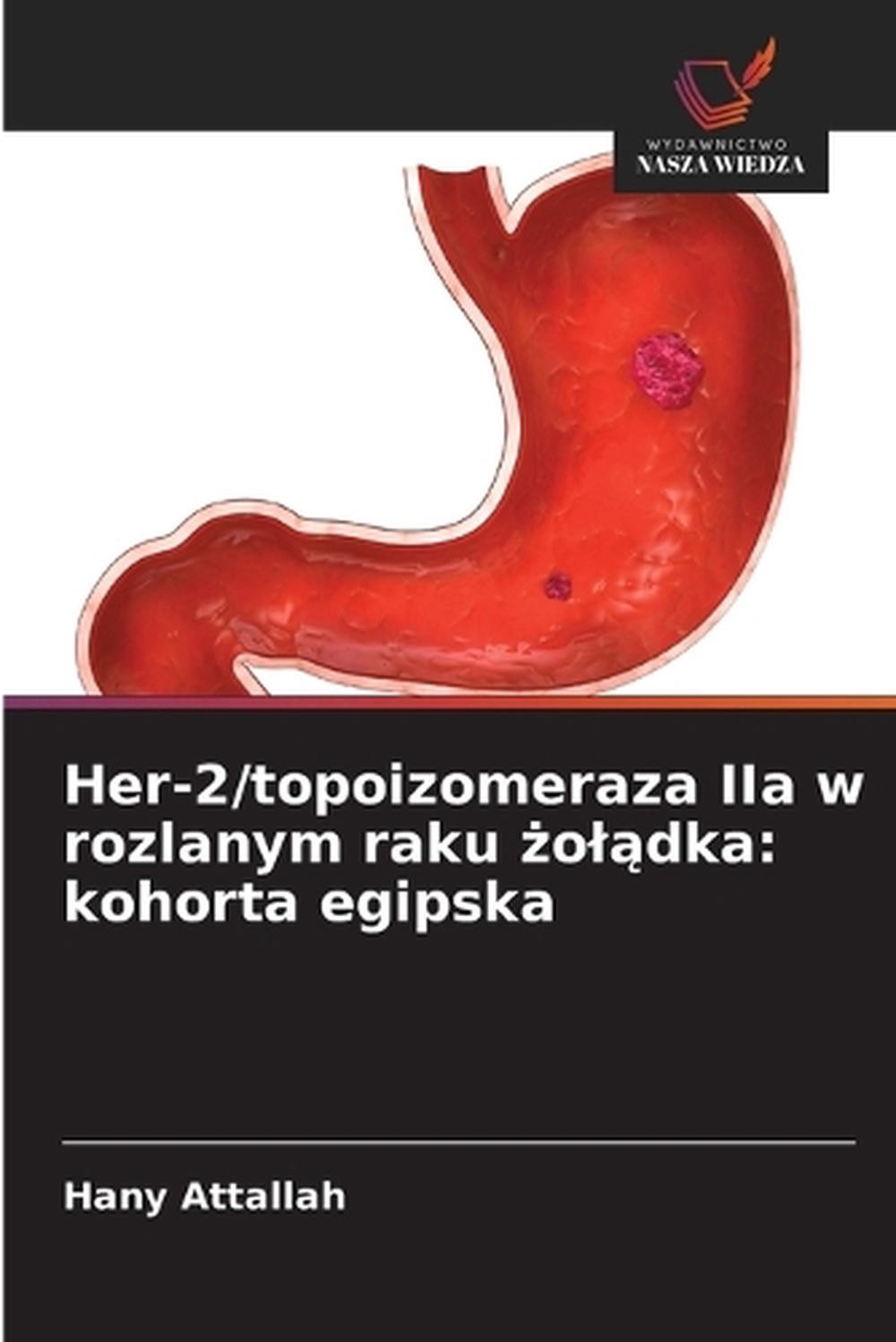 Her-2/topoizomeraza IIa w rozlanym raku oldka: kohorta egipska by Hany Attallah