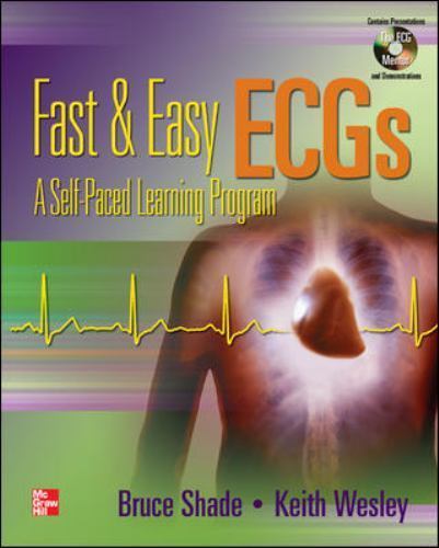 Fast & Easy Ecgs with DVD [With DVD] by Shade, Bruce; Shade Bruce; Wesley, Keith