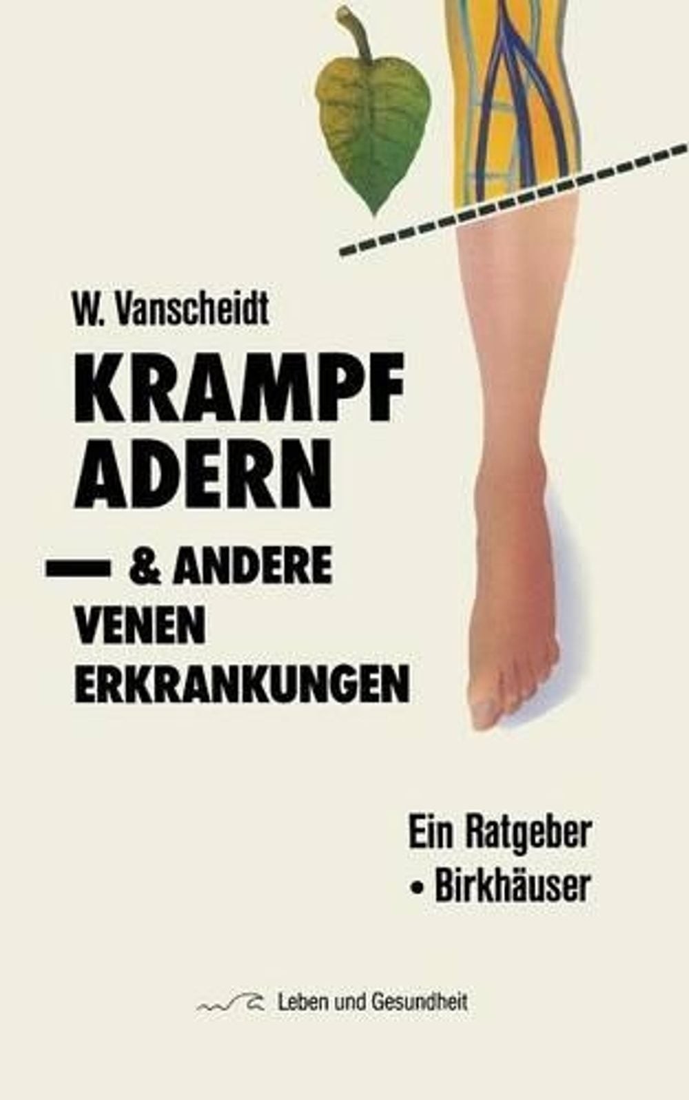 Krampfadern und andere Venenerkrankungen: Ein Ratgeber by W. Vanscheidt (German)
