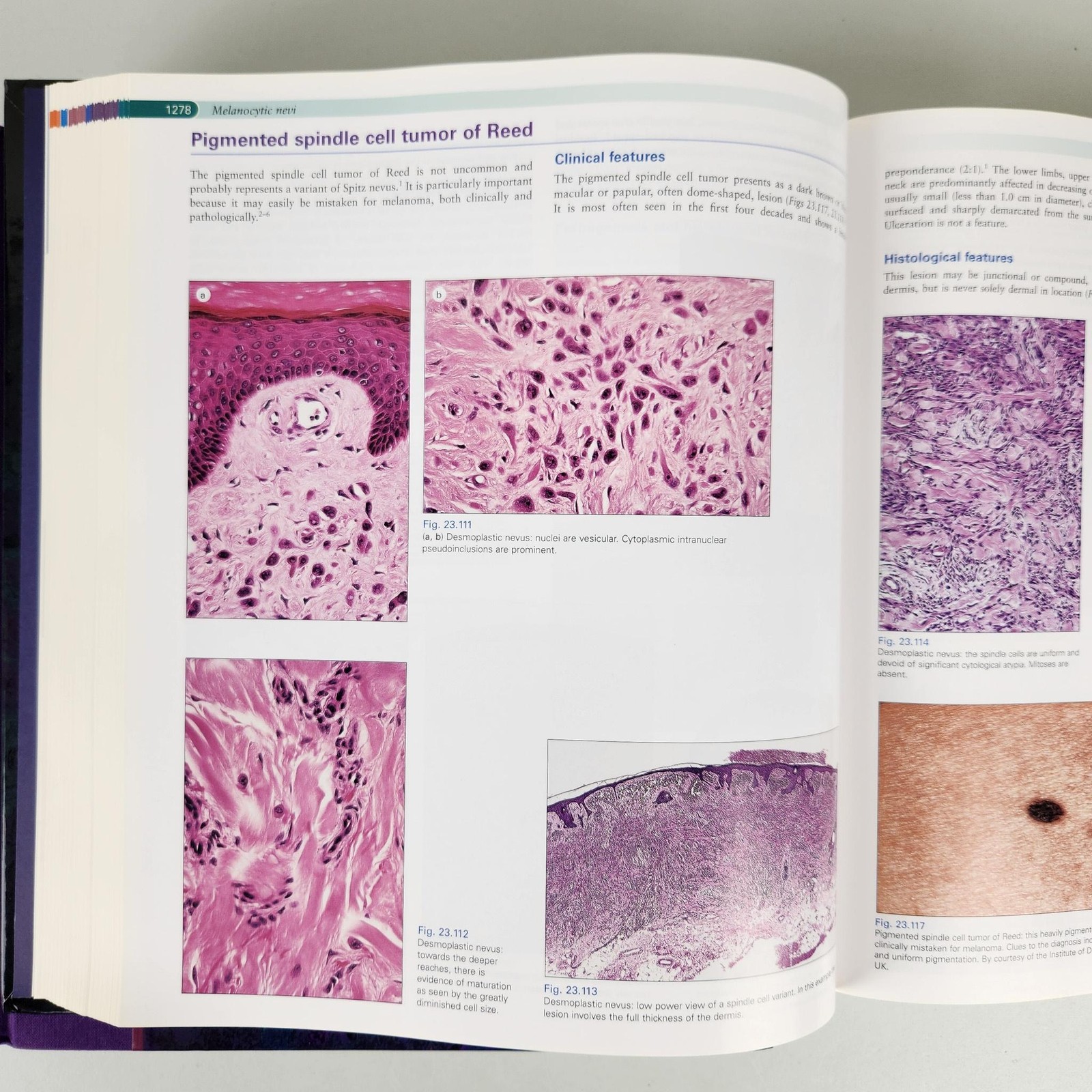 Pathology Of The Skin Clinical Correlations 3rd Edition Volumes 1 & 2 McKee