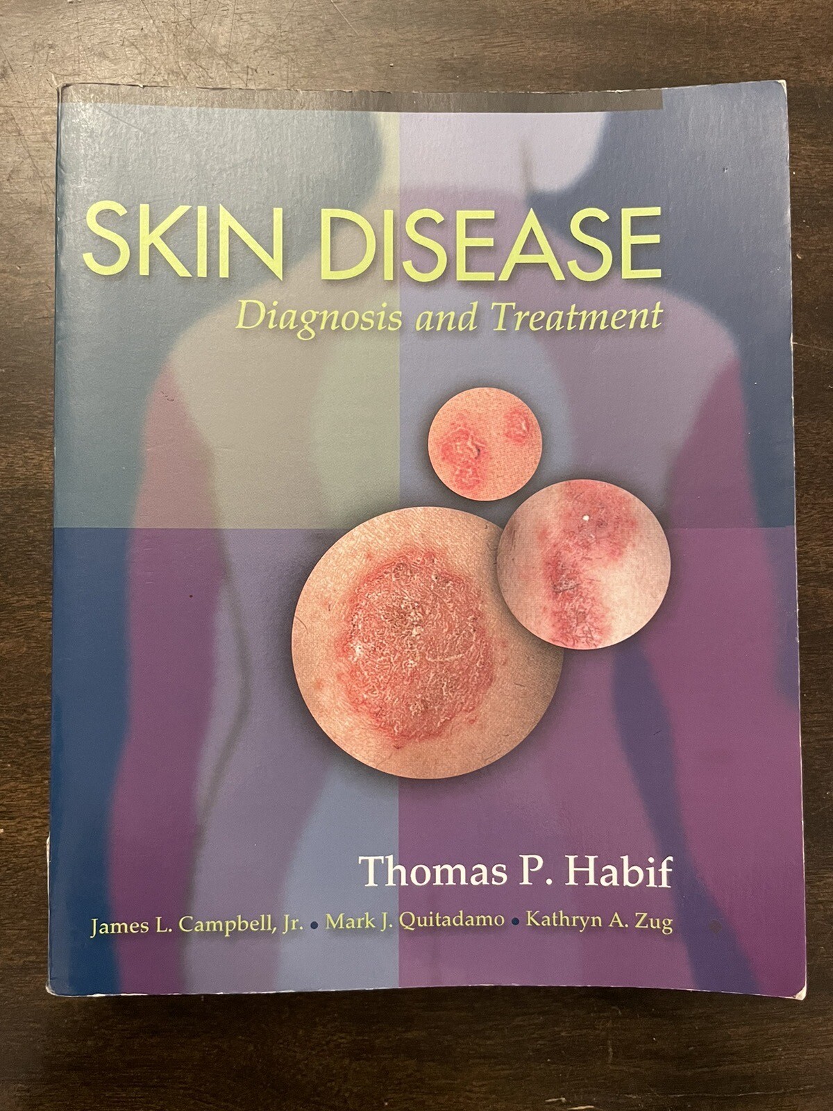 Skin Disease : Diagnosis and Treatment by Thomas P. Habif (2001, Paperback)