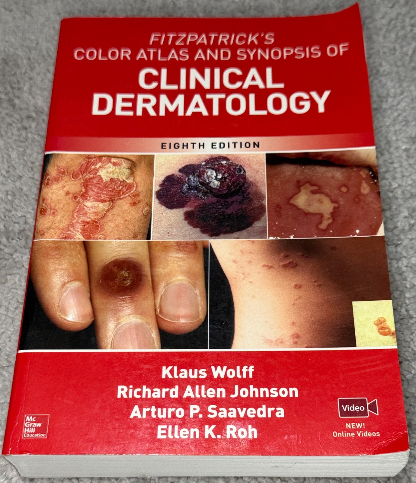 Fitzpatrick’s Color Atlas Clinical Dermatology 8th Edition Paperback Klaus Wolff