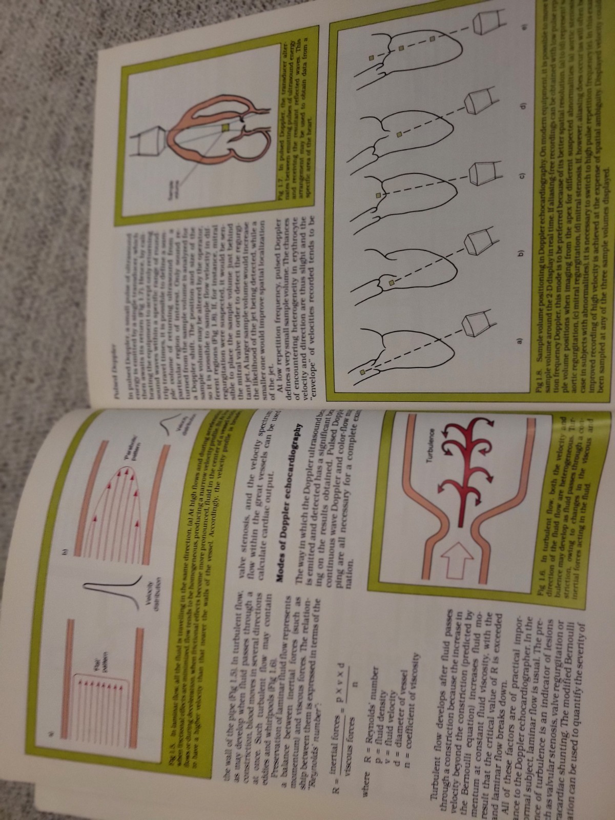 Echocardiography Made Easy Bundle