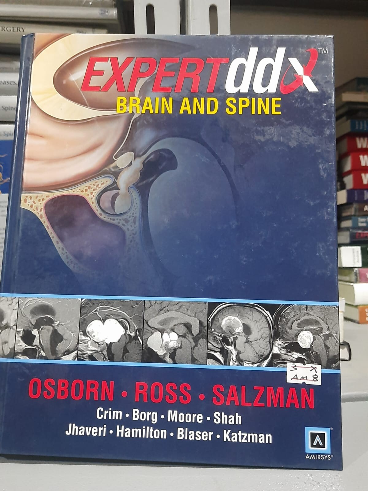 Expertddx Brain and Spine