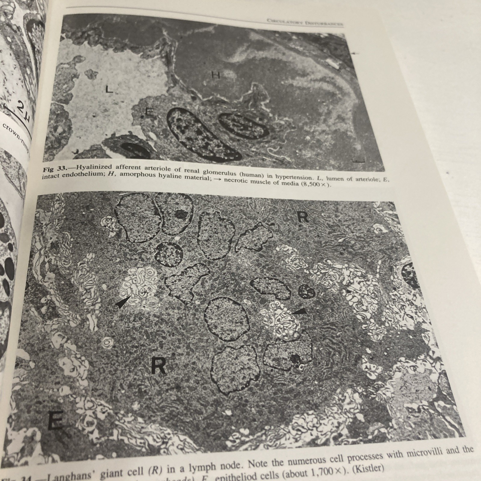 Sandritter’s Color Atlas and Textbook of Histopathology by Carlos Thomas 7th Ed