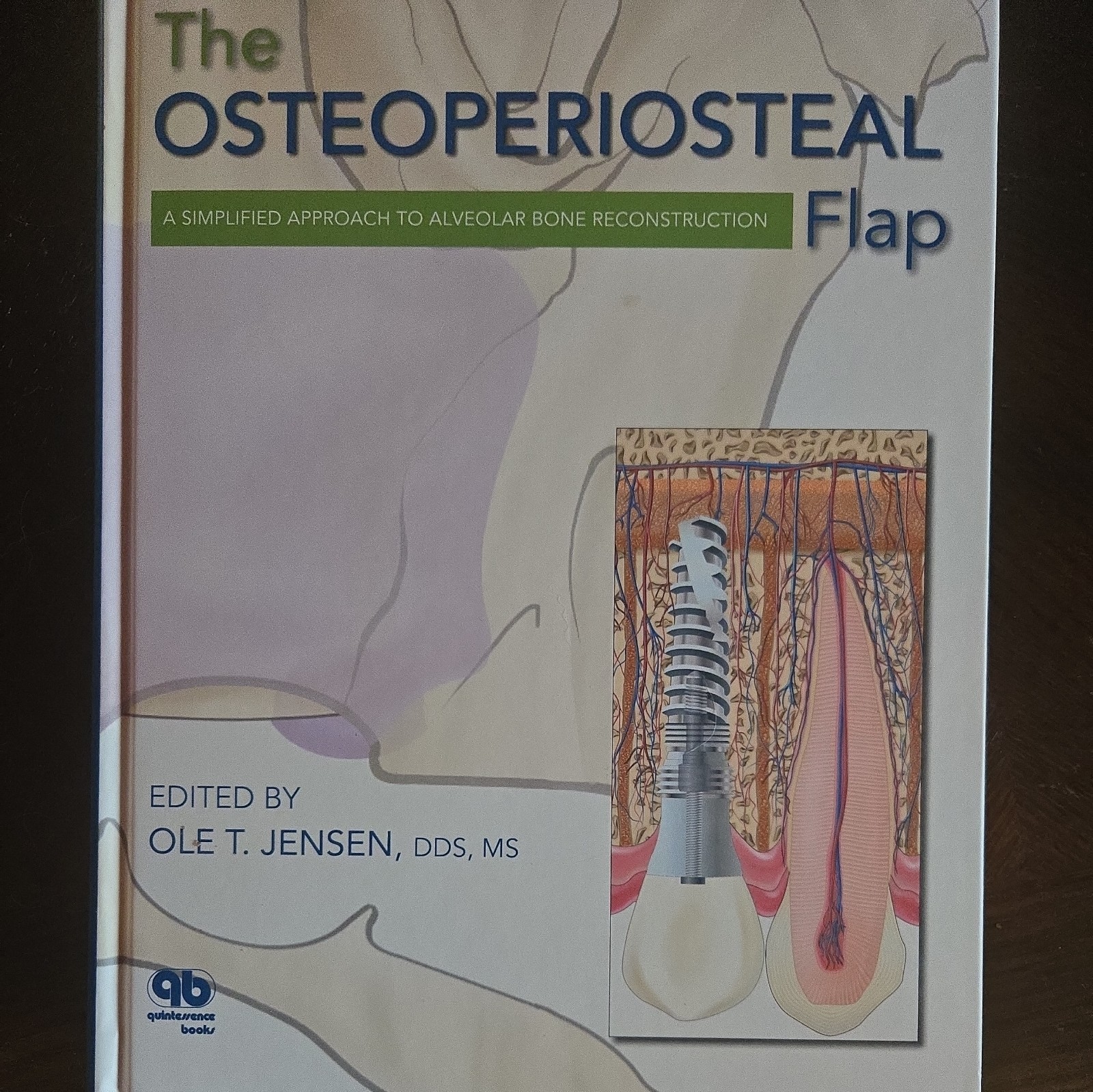 Osteoperiosteal Flap : A Simplified Approach to Alveolar Bone Reconstruction by
