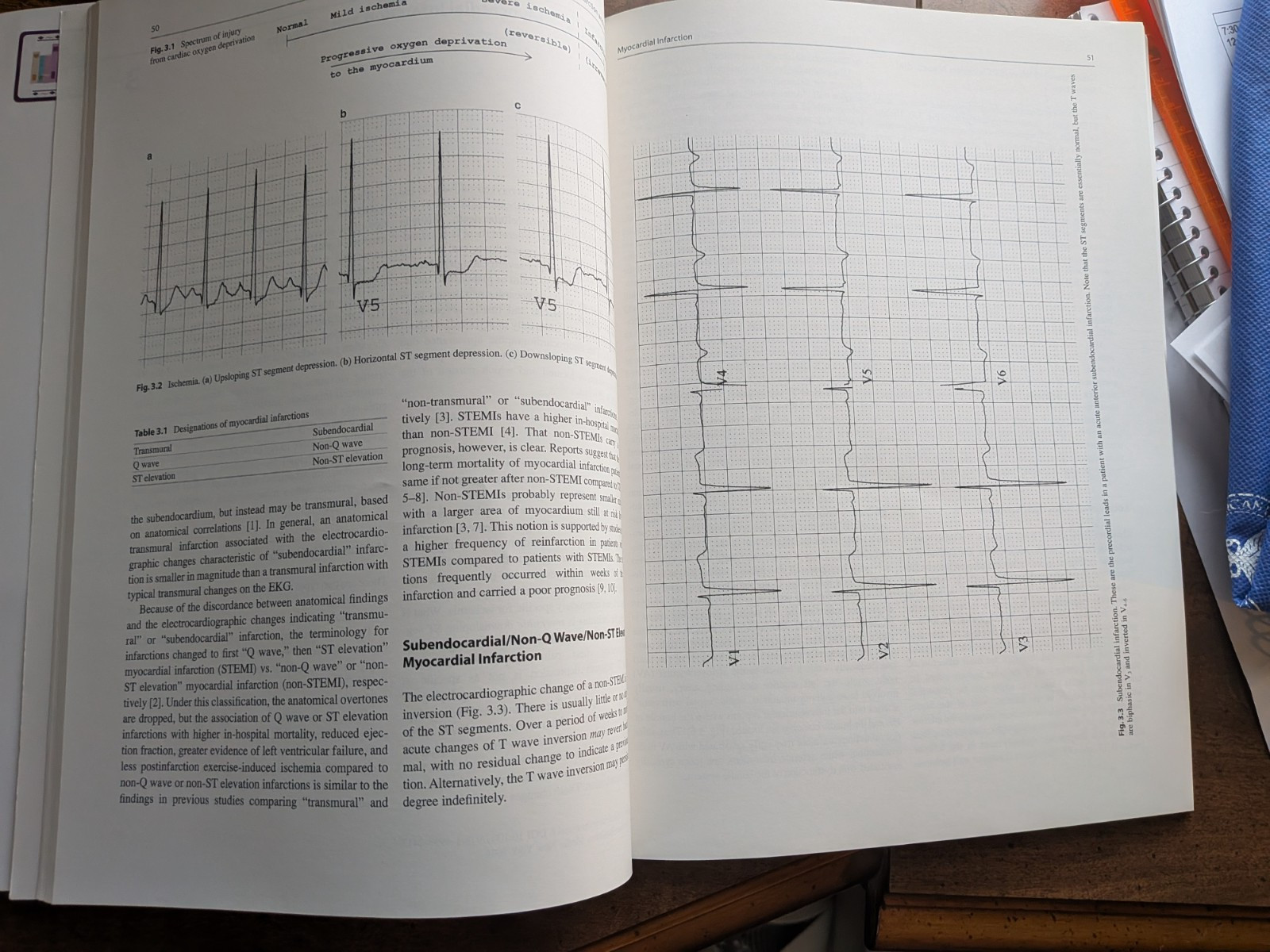 Basic Electrocardiography by Brent G. Petty (2020, Trade Paperback).