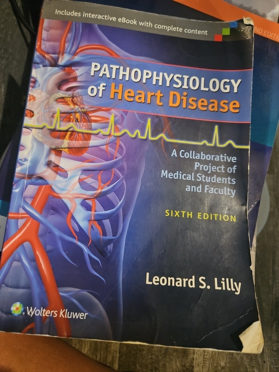 Pathophysiology of Heart Disease : A Collaborative Project