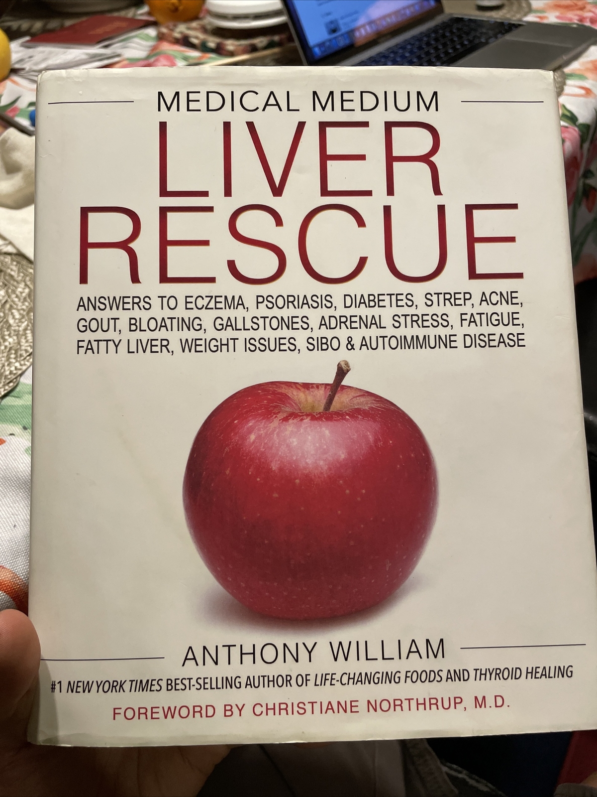 Medical Medium Liver Rescue by Anthony William (Hay House Inc., 2018, Hardcover)